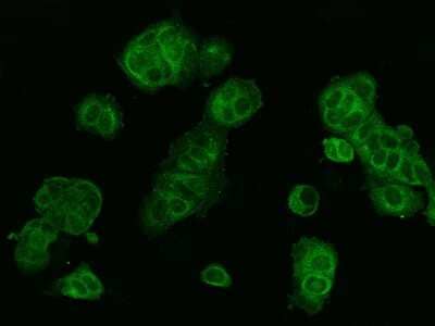 Immunocytochemistry/Immunofluorescence: WWOX Antibody [NBP2-97814] - Immunofluorescence staining of WWOX in MCF7 cells. Cells were fixed with 4% PFA, permeabilzed with 0.1% Triton X-100 in PBS, blocked with 10% serum, and incubated with rabbit anti-Human WWOX polyclonal antibody (dilution ratio 1:200) at 4C overnight. Then cells were stained with the Alexa Fluor(R)488-conjugated Goat Anti-rabbit IgG secondary antibody (green). Positive staining was localized to Cytoplasm.