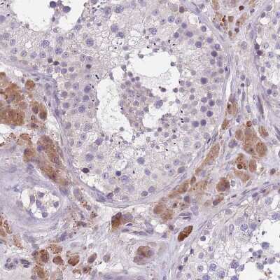 Immunohistochemistry: WWOX Antibody [NBP2-47579] - Staining of human testis shows moderate cytoplasmic positivity in Leydig cells.