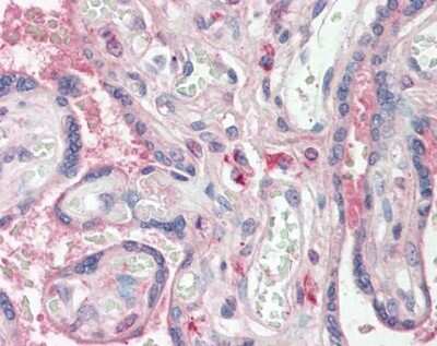 Immunohistochemistry-Paraffin: WWOX Antibody [NBP1-33456] - WWOX antibody detects WWOX protein at cytoplasm on human placenta by immunohistochemical analysis. Sample: Paraffin-embedded placenta. WWOX antibody dilution: 1:100.