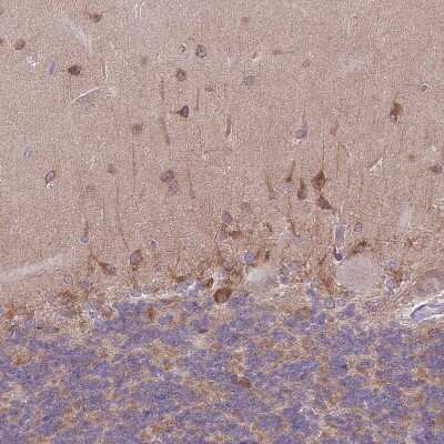 Immunohistochemistry-Paraffin: WWOX Antibody [NBP2-47579] - Staining of human cerebellum shows weak to moderate cytoplasmic positivity in cells in molecular layer.