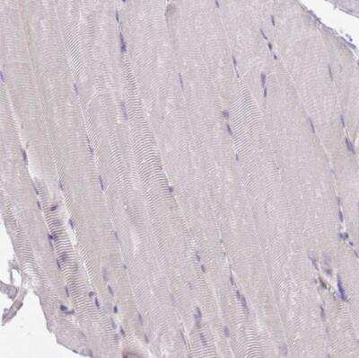 Immunohistochemistry-Paraffin: WWOX Antibody [NBP2-47579] - Staining of human skeletal muscle shows no postivity in myoctyes as expected.