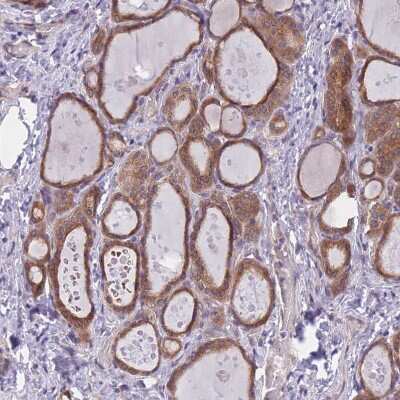 Immunohistochemistry-Paraffin: WWOX Antibody [NBP2-47579] - Staining of human thyroid gland shows strong cytoplasmic positivity in glandular cells.