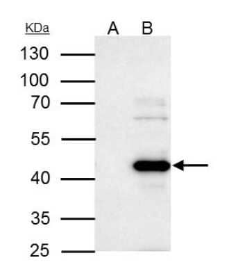 Immunoprecipitation: WWOX Antibody [NBP1-33456] - WWOX antibody immunoprecipitates WWOX protein in IP experiments. IP samples: 293T whole cell extract. A. Control with 4 µg of preimmune Rabbit IgG. B. Immunoprecipitation of WWOX protein by 4 µg WWOX antibody. 10 % SDS-PAGE. The immunoprecipitated WWOX protein was detected by WWOX antibody diluted at 1:500.