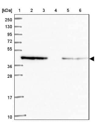 Western Blot: WWOX Antibody [NBP2-47579] - Lane 1: Marker  [kDa] 250, 130, 95, 72, 55, 36, 28, 17, 10.  Lane 2: Human cell line RT-4.  Lane 3: Human cell line U-251MG.  Lane 4: Human plasma (IgG/HSA depleted).  Lane 5: Human liver tissue.  Lane 6: Human tonsil tissue.