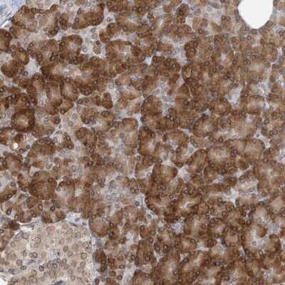 Immunohistochemistry-Paraffin WWP1 Antibody - BSA Free
