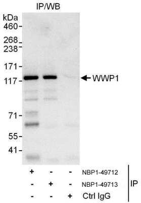 Immunoprecipitation: WWP1 Antibody [NBP1-49713] - Samples:  Whole cell lysate (1 mg for IP, 20% of IP loaded) from HeLa cells.  Antibodies: Affinity purified rabbit anti-WWP1 antibody NBP1-49713 used for IP at 3 ug/mg lysate.  WWP1 was also immunoprecipitated by rabbit anti-WWP1 antibody NBP1-49712, which recognizes an upstream epitope.  For blotting immunoprecipitated WWP1, NBP1-49712 was used at 1 ug/ml.  Detection: Chemiluminescence with an exposure time of 10 seconds.