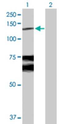 Western Blot: WWP1 Antibody [H00011059-D01P] - Analysis of WWP1 expression in transfected 293T cell line by WWP1 polyclonal antibody.Lane 1: WWP1 transfected lysate(105.20 KDa).Lane 2: Non-transfected lysate.