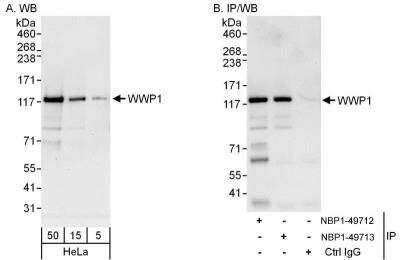 Western Blot: WWP1 Antibody [NBP1-49712] - Samples:  Whole cell lysate (5, 15 and 50 ug for WB; 1 mg for IP, 20% of IP loaded) from HeLa cells.  Antibodies: Affinity purified rabbit anti-WWP1 antibody NBP1-49712 used for WB at 0.1 ug/ml (A) and 1 ug/ml (B) and used for IP at 3 ug/mg lysate.  WWP1 was also immunoprecipitated by rabbit anti-WWP1 antibody NBP1-49713, which recognizes a downstream epitope.  Detection: Chemiluminescence with exposure times of 30 seconds (A) and 10 seconds (B).