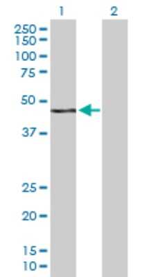 Western Blot: WWP2 Antibody [H00011060-D01P] - Analysis of WWP2 expression in transfected 293T cell line by WWP2 polyclonal antibody.Lane 1: WWP2 transfected lysate(35.20 KDa).Lane 2: Non-transfected lysate.