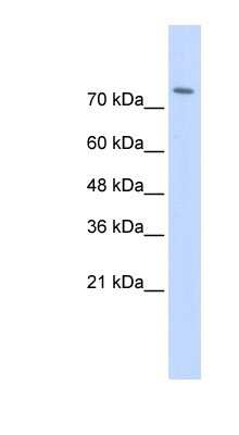 Western Blot: WWP2 Antibody [NBP1-53089] - Titration: 0.2-1 ug/ml, Positive Control: Transfected 293T.