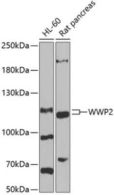 Western Blot: WWP2 Antibody [NBP2-95211] - Analysis of extracts of various cell lines, using WWP2 at 1:1000 dilution. Secondary antibody: HRP Goat Anti-Rabbit IgG (H+L) at 1:10000 dilution. Lysates/proteins: 25ug per lane. Blocking buffer: 3% nonfat dry milk in TBST. Detection: ECL Basic Kit . Exposure time: 60s.