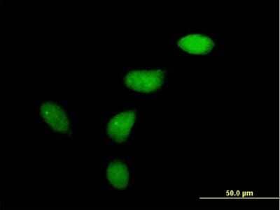 Immunocytochemistry/Immunofluorescence: Wee1 Antibody [H00007465-B01P] - Analysis of purified antibody to WEE1 on HeLa cell. (antibody concentration 10 ug/ml)