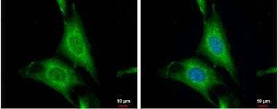 Immunocytochemistry/Immunofluorescence: Wnt-10a Antibody [NBP1-33039] - SKNSH cells were fixed in 4% paraformaldehyde at RT for 15 min. Green: WNT10A protein stained by WNT10A antibody [N1C1-2] diluted at 1:500. Blue: Hoechst 33342 staining.