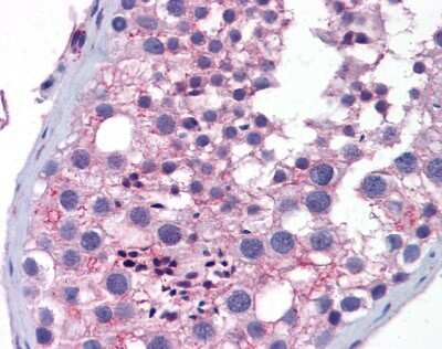 Immunohistochemistry-Paraffin: Wnt-10a Antibody [NBP1-69116] - Human testis tissue at an antibody concentration of 4-8ug/ml.