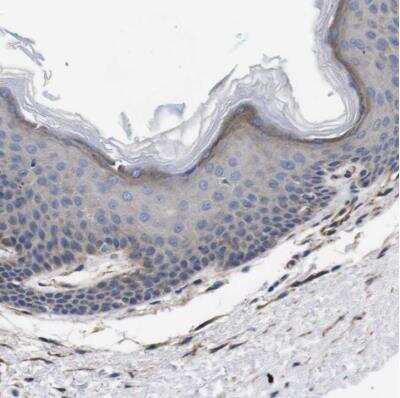 Immunohistochemistry-Paraffin: Wnt-10a Antibody [NBP1-86081] - Staining of human skin shows weak cytoplasmic positivity in epidermal cells.