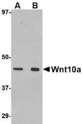 Western Blot: Wnt-10a Antibody [NBP1-76916] - RAW264.7 cell lysate with Wnt10a antibody at (A) 1 and (B) 2 ug/ml.