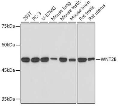 Western Blot: Wnt-2b Antibody (9M6O7) [NBP3-15772] - Western blot analysis of extracts of various cell lines, using Wnt-2b Rabbit mAb (NBP3-15772) at 1:1000 dilution. Secondary antibody: HRP Goat Anti-Rabbit IgG (H+L) at 1:10000 dilution. Lysates/proteins: 25ug per lane. Blocking buffer: 3% nonfat dry milk in TBST. Detection: ECL Basic Kit. Exposure time: 10s.