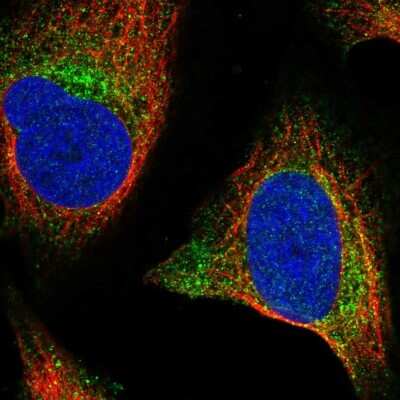 Immunocytochemistry/Immunofluorescence: Wnt-2b Antibody [NBP2-56921] - Staining of human cell line U-2 OS shows localization to vesicles.