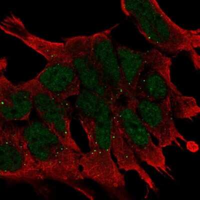 Immunocytochemistry/Immunofluorescence: Wnt-2b Antibody [NBP2-68677] - Staining of human cell line AF22 shows localization to nucleoplasm & vesicles.