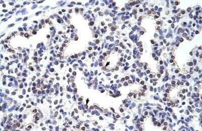 Immunohistochemistry-Paraffin: Wnt-2b Antibody [NBP1-53120] - Human Lung Alveolar cells (indicated with arrows), 4-8ug/ml.