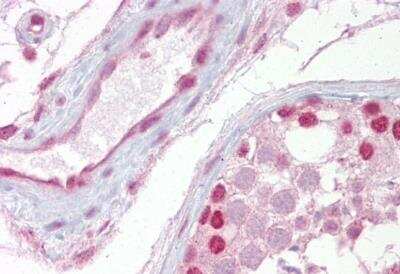 Immunohistochemistry-Paraffin: Wnt-2b Antibody [NBP1-53120] - Human Testis.