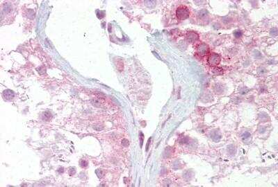 Immunohistochemistry-Paraffin: Wnt-2b Antibody [NBP1-53123] - Human testis tissue 5ug/ml