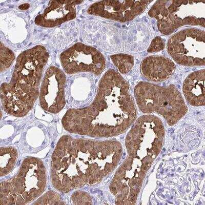 Immunohistochemistry-Paraffin: Wnt-2b Antibody [NBP2-32562] - Staining of human kidney shows strong cytoplasmic, nuclear and membranous positivity in proximal tubules.