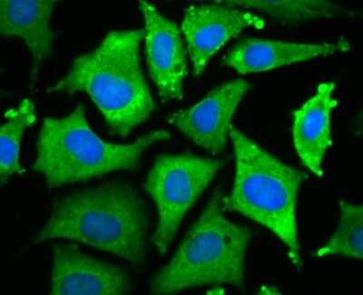 Immunocytochemistry/Immunofluorescence: Wnt-2b Antibody (JB48-34) [NBP2-75713] - Staining Wnt2b in SHSY-5Y cells (green). The nuclear counter stain is DAPI (blue). Cells were fixed in paraformaldehyde, permeabilised with 0.25% Triton X100/PBS.