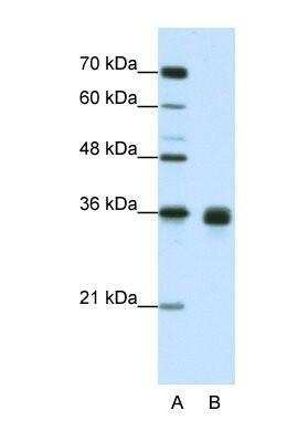 Western Blot: Wnt-2b Antibody [NBP1-53120] - Jurkat tissue lysate at a concentration of 1.25ug/ml.