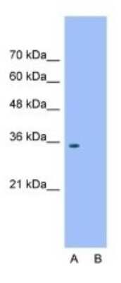 Western Blot: Wnt-2b Antibody [NBP1-53120] - Jurkat Lane A: Primary Antibody Lane B: Primary Antibody + Blocking Peptide Primary Antibody Concentration: 1. 25 ug/ml Peptide Concentration: 4.0 ug/ml lysate Quantity: 25ug/ Lane Gel Concentration: 12% .