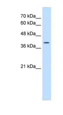 Western Blot: Wnt-2b Antibody [NBP1-53123] - HepG2 cell lysate, Antibody Titration: 0.2-1 ug/ml