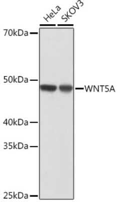 Western Blot: Wnt-5a Antibody (3P2E8) [NBP3-15684] - Western blot analysis of extracts of various cell lines, using Wnt-5a antibody (NBP3-15684) at 1:1000 dilution. Secondary antibody: HRP Goat Anti-Rabbit IgG (H+L) at 1:10000 dilution. Lysates/proteins: 25ug per lane. Blocking buffer: 3% nonfat dry milk in TBST. Detection: ECL Basic Kit. Exposure time: 10s.