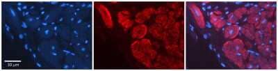 Immunohistochemistry: Wnt-5a Antibody [NBP1-60032] - Human Adult heart Observed Staining: Cytoplasmic,Membrane Primary Antibody Concentration: 1 : 600 Secondary Antibody: Donkey anti-Rabbit-Cy2/3 Secondary Antibody Concentration: 1 : 200 Magnification: 20X Exposure Time: 0.5 2.0 sec.