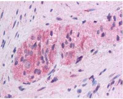 Immunohistochemistry-Paraffin: Wnt-5a Antibody [NBP1-60032] - Human Colon, Myenteric Plexus: Formalin-Fixed, Paraffin-Embedded (FFPE)