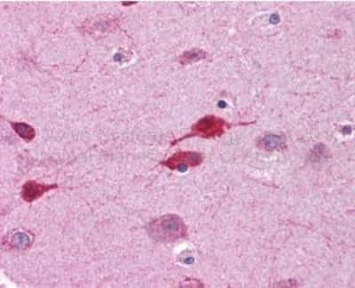 Immunohistochemistry-Paraffin: Wnt-5a Antibody [NBP1-60032] - Human Placenta: Formalin-Fixed, Paraffin-Embedded (FFPE)