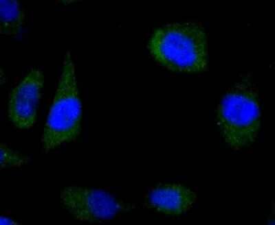 Immunocytochemistry/Immunofluorescence: Wnt-5a Antibody (JU30-30) [NBP2-75714] - Staining Wnt5a in PC-3M cells (green). The nuclear counter stain is DAPI (blue). Cells were fixed in paraformaldehyde, permeabilised with 0.25% Triton X100/PBS.