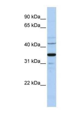 Western Blot: Wnt-5a Antibody [NBP1-60032] - Hela Cell Lysate 1.0 ug/ml, gel concentration 12%