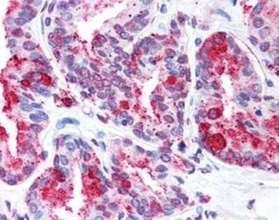 Immunohistochemistry-Paraffin: Wnt-5b Antibody - BSA Free [NB100-90598] - Analysis of anti-WNT5B antibody with human prostate at concentration 5 ug/ml.