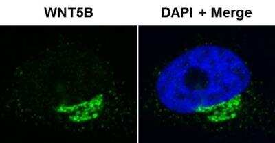 Immunocytochemistry/Immunofluorescence: Wnt-5b Antibody [H00081029-D01P] - analysis of Wnt-5b in HeLa cells using anti-Wnt-5b antibody. Image from verified customer review.