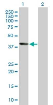 Western Blot Wnt-5b Antibody