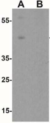 Western Blot Wnt-5b Antibody - BSA Free