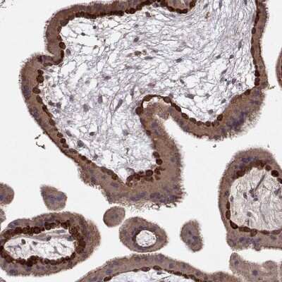 Immunohistochemistry-Paraffin: Wnt-6 Antibody [NBP2-68908] - Staining of human placenta shows strong nuclear and cytoplasmic positivity in trophoblastic cells.