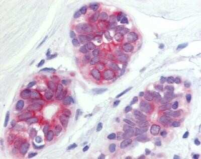 Immunohistochemistry-Paraffin: Wnt-6 Antibody [NB110-55627] - Analysis of anti-WNT6 antibody with human breast, epithelium cells.