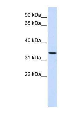 Western Blot: Wnt-6 Antibody [NBP1-62305] - 293T cells lysate, concentration 0.2-1 ug/ml.