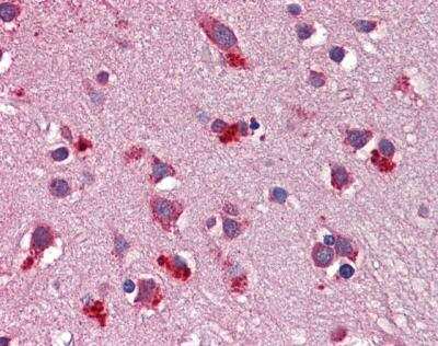 Immunohistochemistry-Paraffin: Wnt-7b Antibody [NBP1-59564] - Human Brain, cortex tissue at an antibody concentration of 4-8ug/ml.