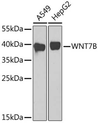 Western Blot: Wnt-7b Antibody [NBP2-93321] - Analysis of extracts of various cell lines, using Wnt-7b at 1:1000 dilution. Secondary antibody: HRP Goat Anti-Rabbit IgG (H+L) at 1:10000 dilution. Lysates/proteins: 25ug per lane. Blocking buffer: 3% nonfat dry milk in TBST. Detection: ECL Basic Kit . Exposure time: 90s.