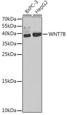 Western Blot: Wnt-7b Antibody [NBP2-93501] - Analysis of extracts of various cell lines, using Wnt-7b at 1:1000 dilution. Secondary antibody: HRP Goat Anti-Rabbit IgG (H+L) at 1:10000 dilution. Lysates/proteins: 25ug per lane. Blocking buffer: 3% nonfat dry milk in TBST. Detection: ECL Basic Kit . Exposure time: 90s.