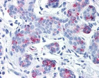 Immunohistochemistry-Paraffin: Wnt-8a Antibody - BSA Free [NB100-90595] - Analysis of anti-WNT8A antibody with human breast at concentration 10-20 ug/ml.