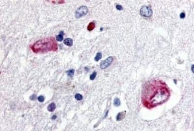 Immunohistochemistry: Wnt-8a Antibody [NBP3-14523] - Immunohistochemistry of brain, caudate, neurons and glia