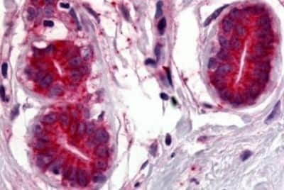 Immunohistochemistry-Paraffin: Wnt-8a Antibody [NBP3-14523] - Immunohistochemistry of formalin-fixed, paraffin-embedded human breast after heat-induced antigen retrieval.